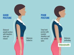 posture correction london chiropractor