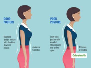 Posture Correction Therapy in London