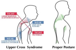 Posture correction chiropractor in London glowchiro