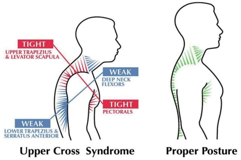 Exercises you can do on vacations to help with your posture correction