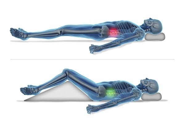 London Chiropractor Tips: Sleeping positions to prevent back pain