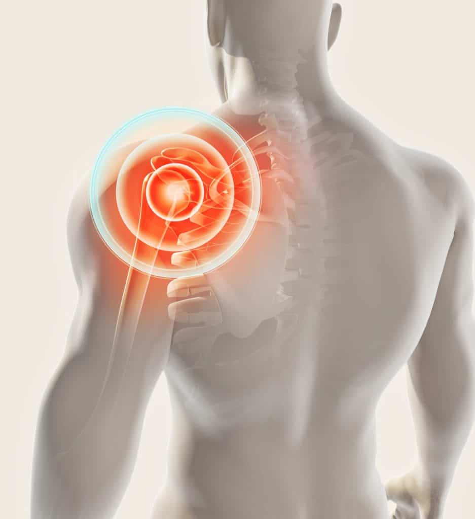 Chiropractic Shoulder Adjustment Relieving Pain